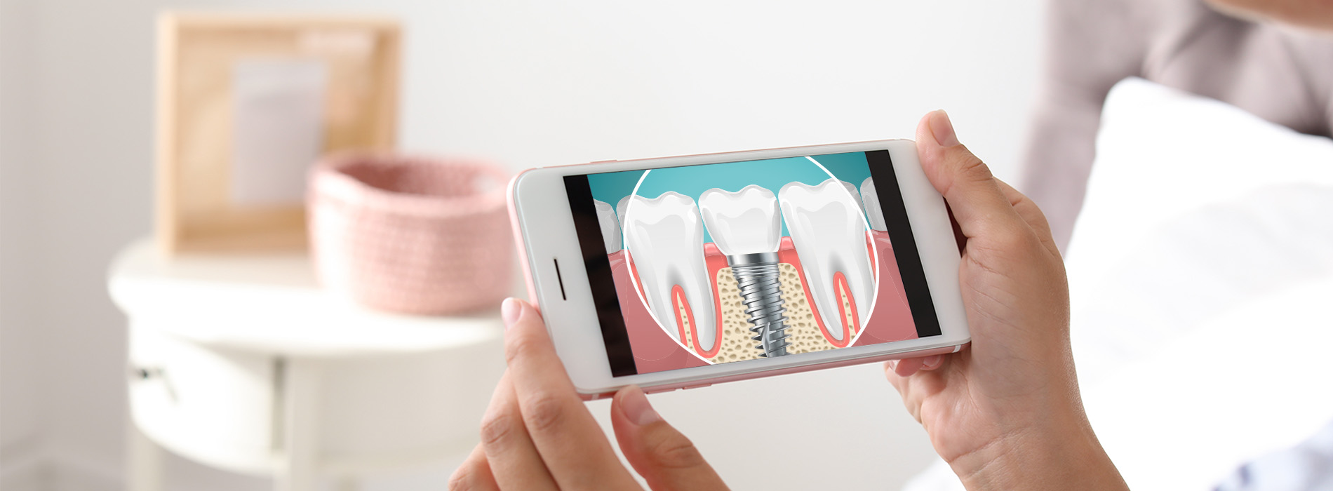 HP Dental | Veneers, Ceramic Crowns and Digital Impressions