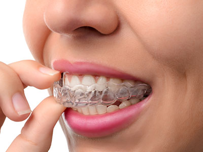 HP Dental | Teeth Whitening, Dental Cleanings and TMJ Disorders