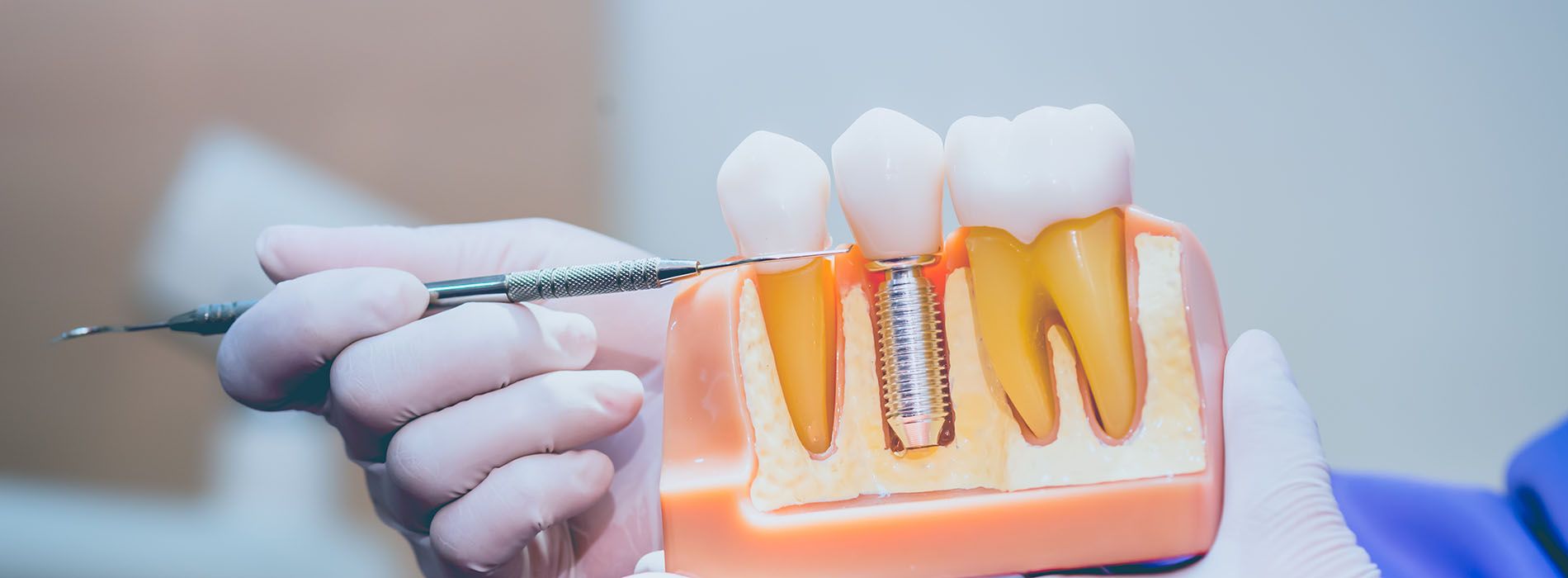HP Dental | Preventative Program, Dentures and Inlays  amp  Onlays