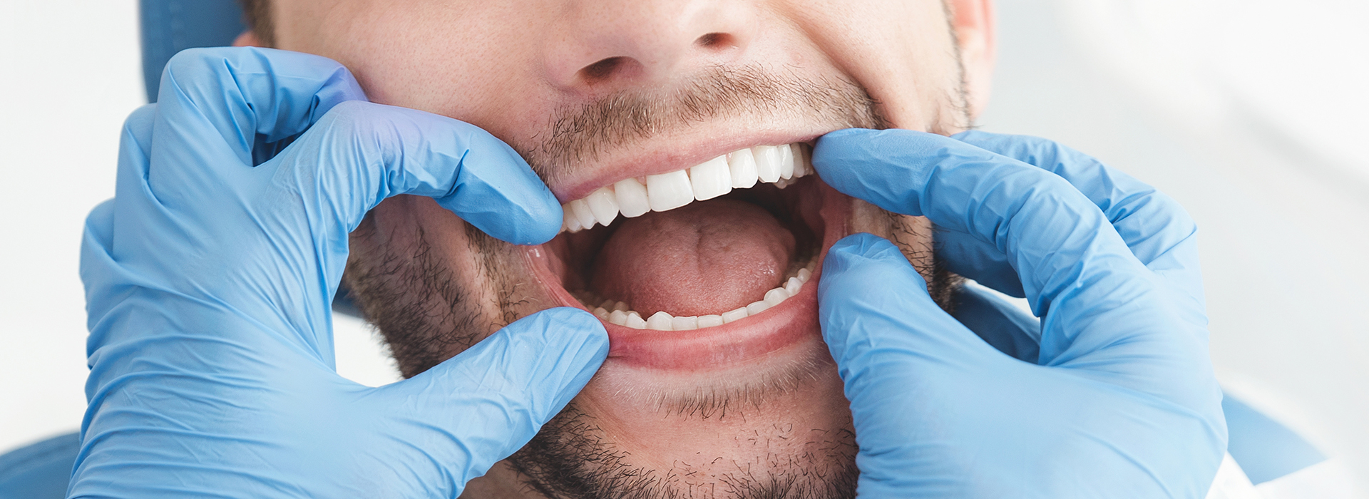 HP Dental | Sports Mouthguards, Dental Fillings and Invisalign reg 
