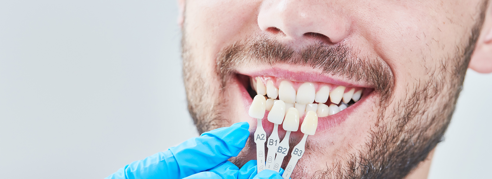 HP Dental | Dentures, Teeth Whitening and Air Abrasion